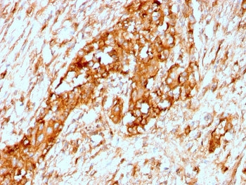 Alpha 1 Antitrypsin Antibody / AAT / SERPINA1