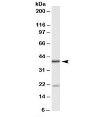 KLHDC8B Antibody