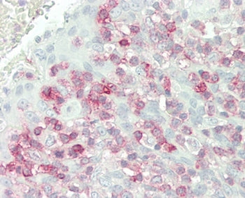 FKBP10 Antibody