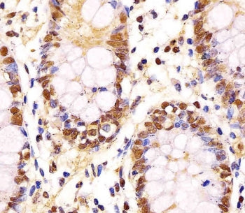 IHC testing of FFPE human colon tissue with GAPDH antibody. HIER: steam section in pH6 citrate buffe