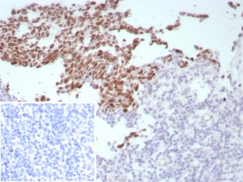 IHC staining of FFPE human tonsil tissue with B-Cell Lymphoma 6 antibody (clone BCL6/8808R). Inset: 