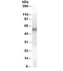 Western blot testing of U937 lysate with LYN antibody at 0.1ug/ml. Predicted molecular weight ~58 kD