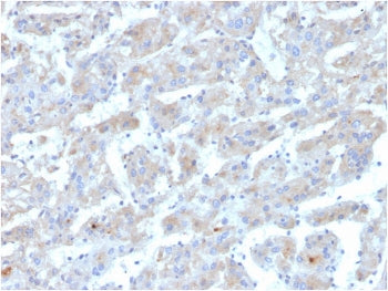 APOB Antibody / Apolipoprotein B