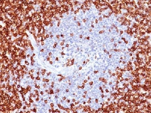 IHC testing of CD45RO antibody and FFPE human tonsil. HIER: boil tissue sections in 10mM citrate buf