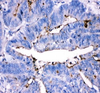 ADA Antibody / Adenosine deaminase