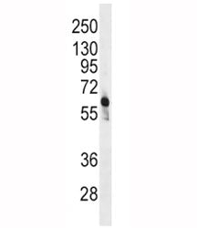 PFKFB3 Antibody