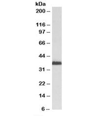 Western blot testing of KELLY cell lysate with MSI2 antibody at 2ug/ml. Predicted molecular weight: 