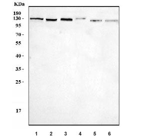 Western blot testing of 1) human Jurkat, 2) human MOLT4, 3) rat brain, 4) mouse brain, 5) mouse RAW2