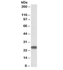 Western blot testing of HEK293 lysate with PSMB4 antibody at 0.3ug/ml. Predicted molecular weight ~2