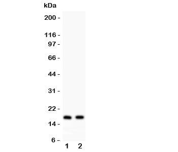 Western blot testing of ANP antibody and Lane 1: rat heart; 2: mouse heart lysate. Predicted molecul
