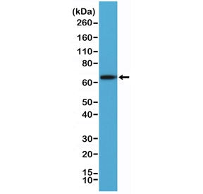 Western blot testing of human A431 cell lysate with recombinant PLAP antibody at 1:2000 dilution. Pr