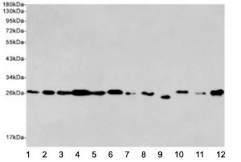 Western blot testing of human 1) Jurkat, 2) HeLa, 3) MCF7, 4) K562, 5) rat C6, 6) mouse NIH3T3, 7) r
