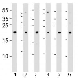 DHFR Antibody