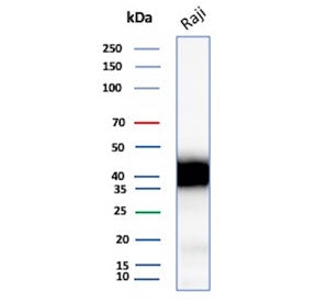 Western blot testing of human Raji cell lysate with recombinant CD48 antibody. Expected molecular we