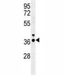 IRF-1 Antibody