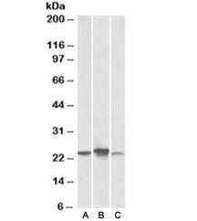Western blot testing of human [A], mouse [B], rat [C] liver lysate with ABHD14B antibody at 0.3ug/ml