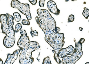 BRAF Antibody (B Raf)