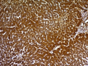Hepatocyte Specific Antigen Antibody