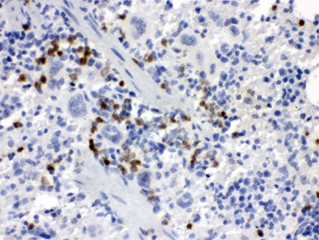 IHC testing of FFPE mouse spleen with Csf-1 antibody. HIER: Boil the paraffin sections in pH 6, 10mM