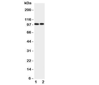Western blot testing of EPB41L1 antibody and Lane 1: rat brain; 2: mouse brain lysate. Predicted/obs