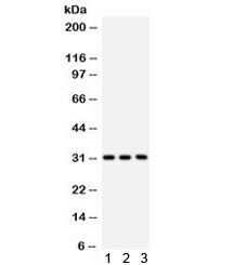 Western blot testing of 1) rat liver, 2) mouse liver and 3) human SMMC lysate with VDAC antibody. Ex