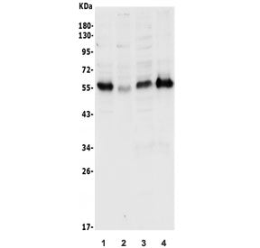 Western blot testing of human 1) Jurkat, 2) HeLa, 3) SW620 and 4) Caco-2 lysate with CDKN1C antibody