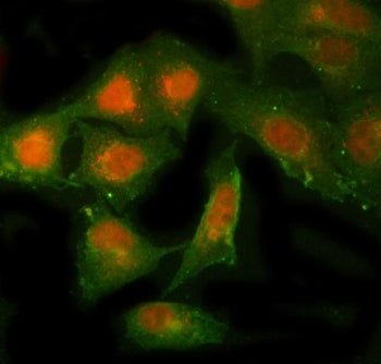 Immunofluorescent staining of FFPE human A549 cells with NBR1 antibody (red) and Beta Tubulin mAb (g
