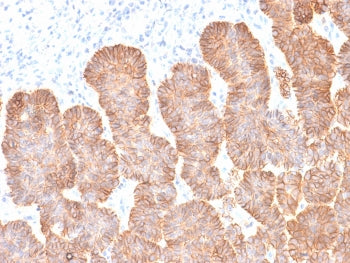 IHC testing of FFPE human skin with recombinant EpCAM antibody (clone rEGP40/1372). Required HIER: b