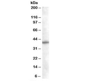 Western blot testing of Daudi lysate with SNX16 antibody at 0.05ug/ml. Predicted molecular weight: ~