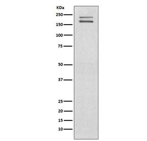 Western blot testing of human SH-SY5Y cell lysate with c-Ret antibody. Expected molecular weight: 15