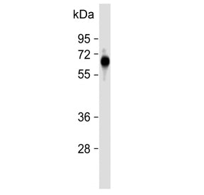 Western blot testing of human placental tissue with FPGS antibody. Predicted molecular weight ~65 kD