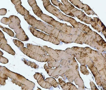 TNNI1 Antibody / Troponin I slow skeletal muscle