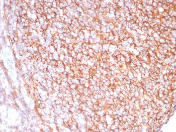 IHC staining of FFPE human tonsil tissue with CD21 antibody (clone CR2/8880R). HIER: boil tissue sec