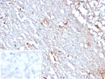IHC staining of FFPE human cerebellum tissue with STAT6 antibody (clone STAT6/7774R). Inset: PBS use