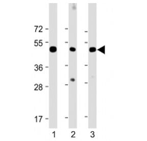 Western blot testing of CHRNE antibody at 1:2000: Lane 1) human skeletal muslce, 2) mouse skeletal m