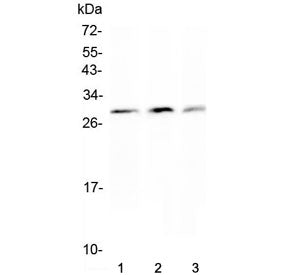 Western blot testing of Kallikrein-2 antibody and Lane 1: PANC; 2: HeLa; 3: 293T cell lysate. Predic