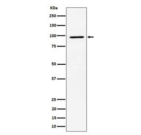 Western blot testing of human MCF7 cell lysate with RSK2 antibody. Predicted molecular weight ~84 kD