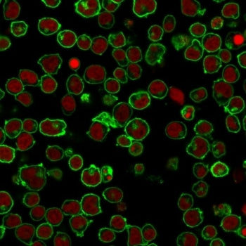 CD45 Antibody (Leukocyte marker)