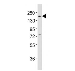 Erbb3 Antibody