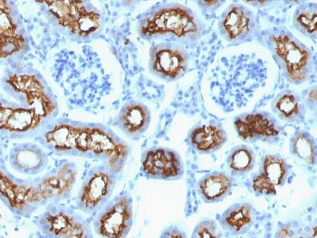 IHC testing of FFPE mouse kidney with CFTR antibody (clone CFTR/1342). Staining of FFPE tissue is en
