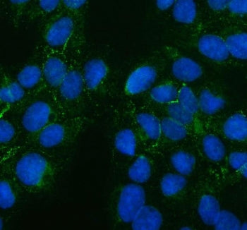 PTH2R Antibody / Parathyroid hormone 2 receptor