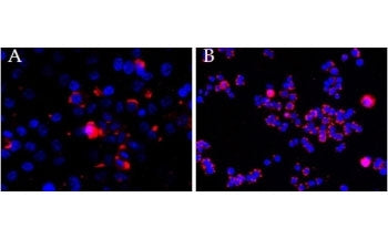 CEP290 Antibody