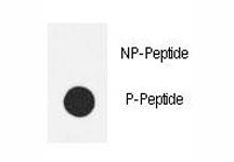 Dot blot analysis of phospho-eNos antibody. 50ng of phos-peptide or nonphos-peptide per dot were spo