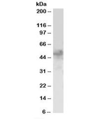 Western blot testing of H460 lysate with FOXQ1 antibody at 1ug/ml. Predicted molecular weight: ~46kD