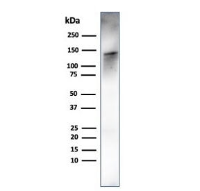 Western blot testing of human ovary tissue lysate using recombinant Caldesmon antibody (clone rCALD1