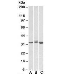 LIVIN Antibody
