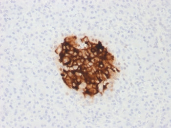 IHC testing of FFPE human pancreas with recombinant Insulin antibody (clone rIRDN/805). Required HIE