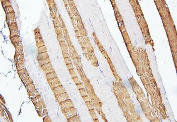 IHC staining of FFPE human skeletal muscle with TNNI2 antibody. HIER: boil tissue sections in pH6, 1