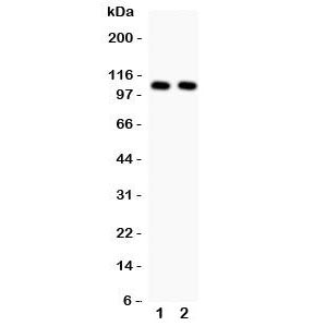 NFKB1 Antibody
