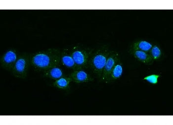Immunofluorescent staining of FFPE human MCF7 cells with FIS1 antibody (green) and DAPI nuclear stai